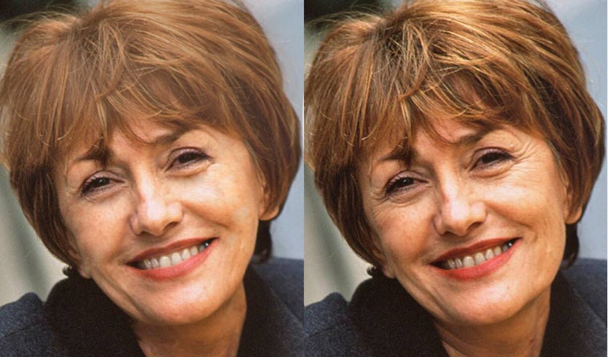 fotografie a feței înainte și după conturare
